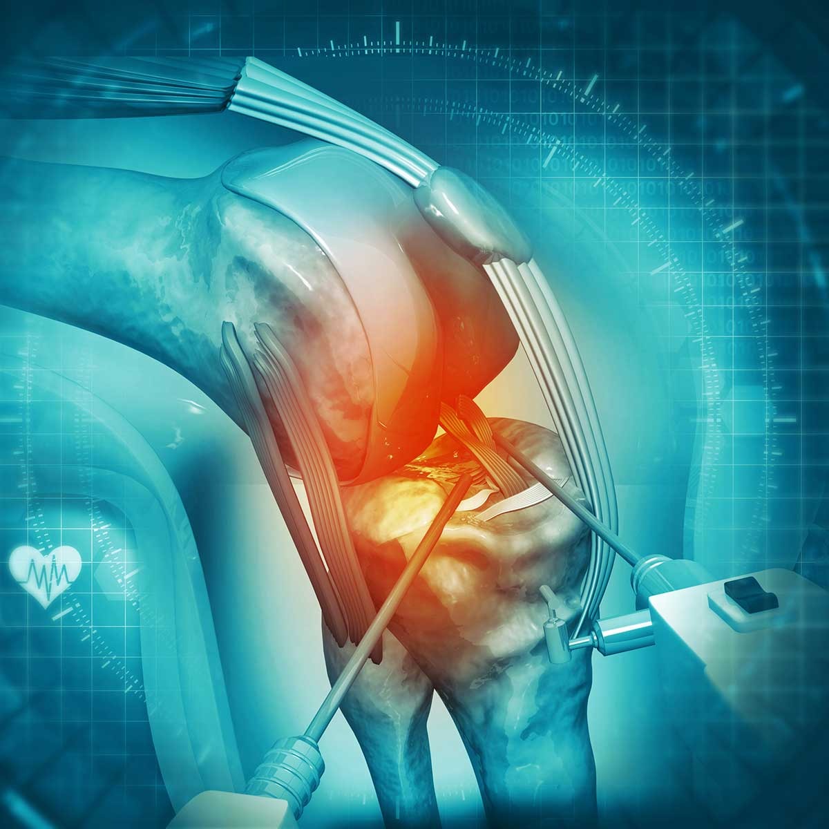 Robotic Hip Replacement in Pune at Jehangir Hospital