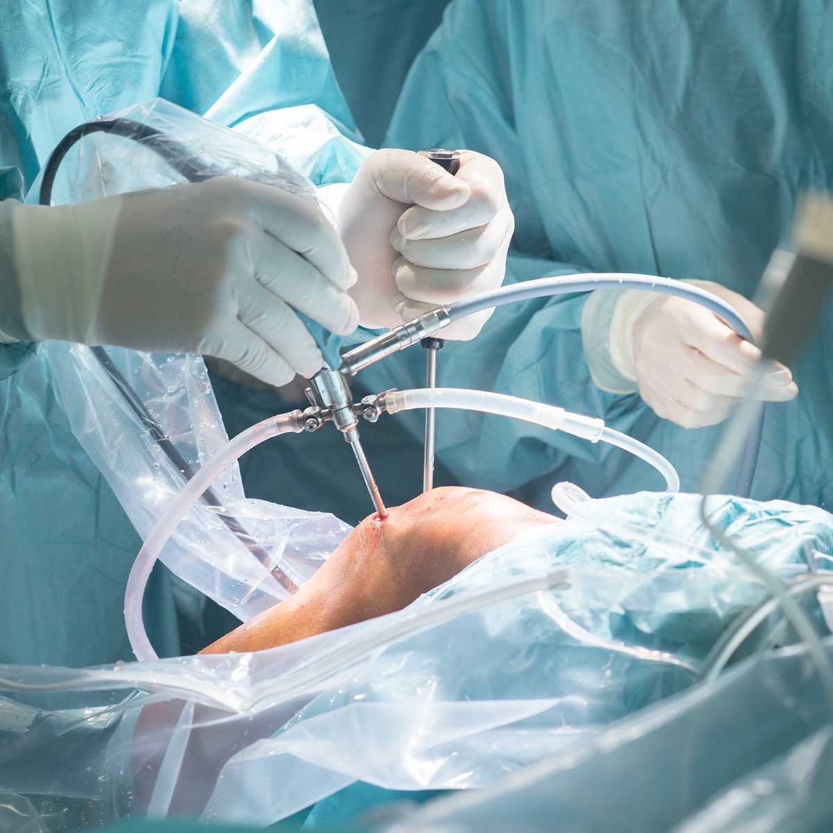 Robotic Knee Replacement Surgery in Pune – Jehangir Hospital 