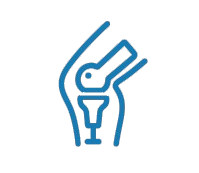 Robotic Knee Replacement